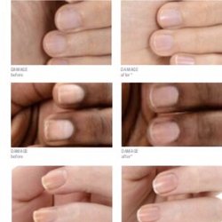 Amazing Skin By Nina Maria,SPA - The before and after is truly Amazing. Call now 248.350.6462