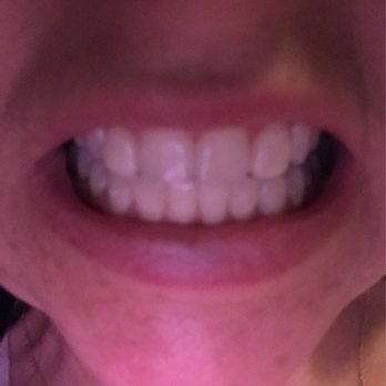 Advanced Smiles Dentistry - Oral Surgeons Near Me - Tijuana, BCN