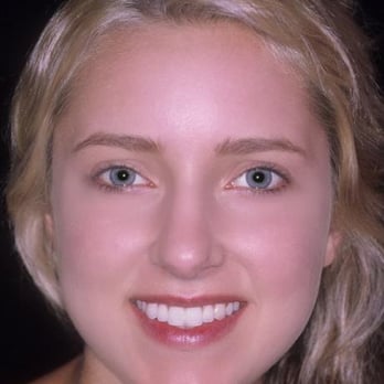 Crutchfield Dermatology - best Acne treatment by Dr. Crutchfield - Dermatologists Near Me - Eagan, Minnesota Crutchfield Dermatology - best Acne treatment by Dr. Crutchfield - Dermatologists Near Me - Eagan, Minnesota