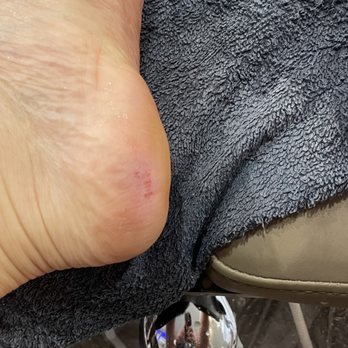 Element Nail Bar - Cut with callus shredder immediately after starting - Nail Salons Near Me - Phoenix, Arizona Element Nail Bar - Cut with callus shredder immediately after starting - Nail Salons Near Me - Phoenix, Arizona