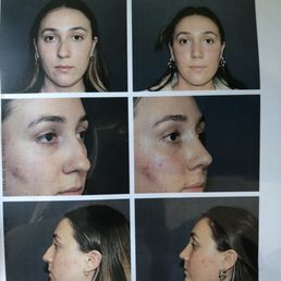 Before and after