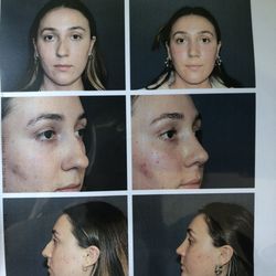 David A. Bray, Jr., M.D - Before and after