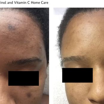 Skin Care By Marlene - Skin Care Near Me - Los Angeles, California Skin Care By Marlene - Skin Care Near Me - Los Angeles, California