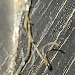 Parasitology Center - Grows on the wall and my skin.