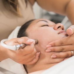 Divine Beauty Inspirations - Microdermabrasion
