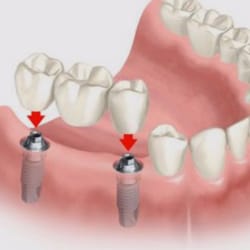 San Dimas Periodontics