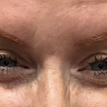 UPKEEP - Today 3 weeks - Medical Spas Near Me - Dallas, Texas UPKEEP - Today 3 weeks - Medical Spas Near Me - Dallas, Texas