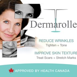 Studio R Salon & Spa - Micro-Needling (Health Canada Approved)