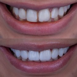 SmileOn Dentistry