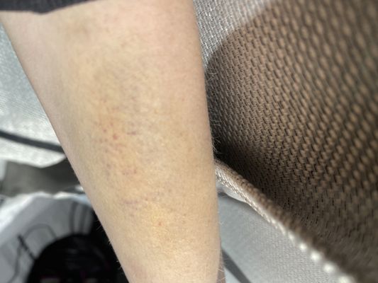 LewisGale Hospital Pulaski Emergency Room