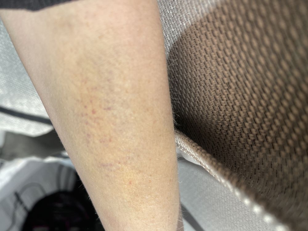 LEWISGALE HOSPITAL PULASKI Updated October 2024 2400 Lee Hwy N