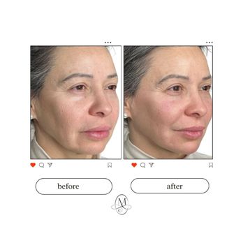 Mycro Aesthetics - Medical Spas Near Me - Gaithersburg, Maryland