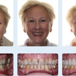 Fried & Roth Orthodontics - Pre ortho, post ortho, and post restorative