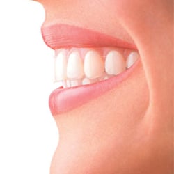 James A. Dicicco, DDS - Perfect Smiles
