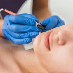 The Traveling Waxer - Waxing, Facials, Electrolysis - Electrolysis for unwanted facial hair.