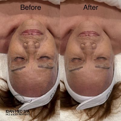 Idan Med Spa by null