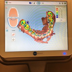 Lifetime Dentistry of Royal Palm - This is where I am grinding my teeth!