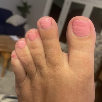 JM Nail Lounge - Notice the jagged, rough edges. Polish was horrid. Notice redness on big toe. - Nail Salons Near Me - Concord, California JM Nail Lounge - Notice the jagged, rough edges. Polish was horrid. Notice redness on big toe. - Nail Salons Near Me - Concord, California