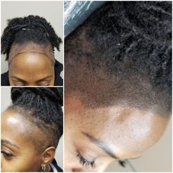 OM SCALP Micropigmentation & Hairline Tattoo Clinic