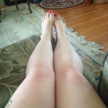 Veintec - The bruised look, discoloration and swelling are gone. - Medical Centers Near Me - San Antonio, Texas Veintec - The bruised look, discoloration and swelling are gone. - Medical Centers Near Me - San Antonio, Texas