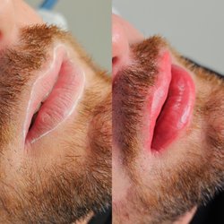 BG Integrative Studio - Lip Micropigmentation for men | Semi permanent Cosmetic Tattoo