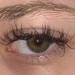 Left eye as of right now