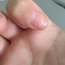 Davi Nails - I went and got my nails done for prom and I took them off 2 weeks ago. They left a indent in my nail. 2 nails at that!