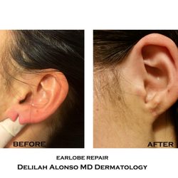 Alonso Dermatology