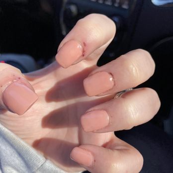 Beverly Hills Nails - Look how bad and painful - Nail Salons Near Me - Pittsburgh, Pennsylvania