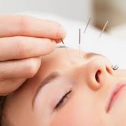 Acupuncture Retreat