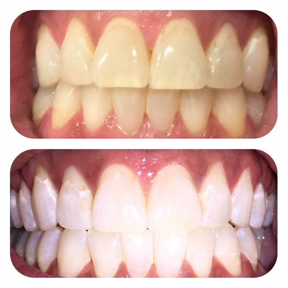 MAUI WHITENING OF MUSIC CITY Updated May 2024 900 Conference Dr, Goodlettsville, Tennessee