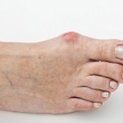 Appalachian Foot & Ankle Associates