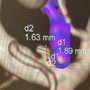 Northwell Health Neurosurgery