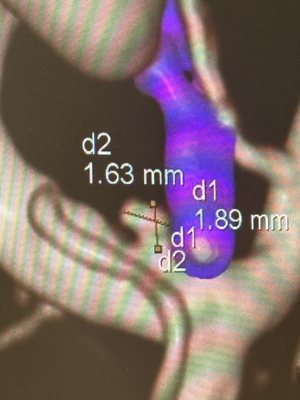 Jamie S Ullman, MD - Northwell Health Neurosurgery