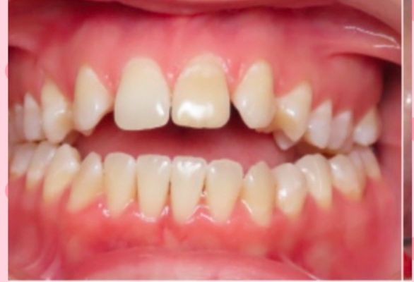 Tru Orthodontics - Springfield