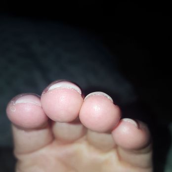 Latoue Nail Spa - Uneven thickness. Gel caked under the nail. - Nail Salons Near Me - Brooklyn, New York Latoue Nail Spa - Uneven thickness. Gel caked under the nail. - Nail Salons Near Me - Brooklyn, New York