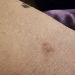 BioLife Plasma Services