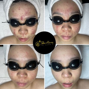 Skin Honey - Skin Care Near Me - Los Angeles, California Skin Honey - Skin Care Near Me - Los Angeles, California