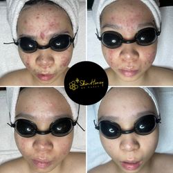 Skin Honey