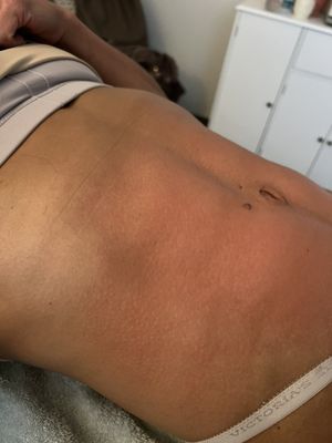 Lipo Lounge Jax by null