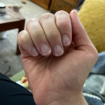 Sapphire Nail Salon - Destroyed nails after getting gel removal. - Nail Salons Near Me - Chicago, Illinois
