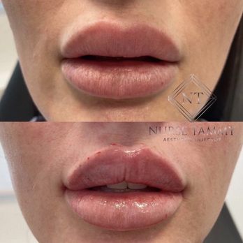 The Aesthetics Lab - Medical Spas Near Me - Las Vegas, Nevada The Aesthetics Lab - Medical Spas Near Me - Las Vegas, Nevada