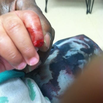 Mini Steps Childcare - MINI STEPS NEGLIGENCE. " PARTIAL TRAUMATIC TRANSPHALANGEAL AMPUTATION OF FINGER OF A 12 MONTH OLD. - Preschools Near Me - Hanover Park, Illinois