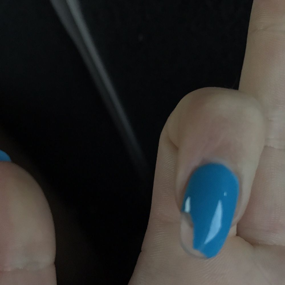 The chipped nail.