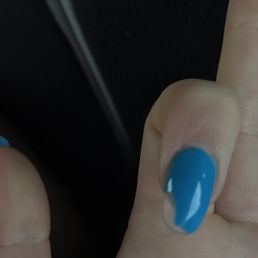The chipped nail. The chipped nail.
