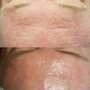 Lydia Marie, Skin RN