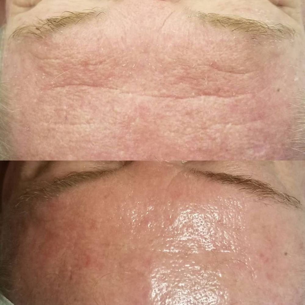 Lydia Marie, Skin RN Logo