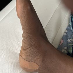 The Good Feet Store - A right foot with a band aid after receiving a Steroid injection from Podiatrist.