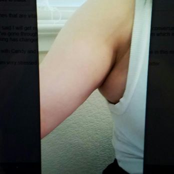 Elite MD - This is what it looks like with my clothes its horrible - Cosmetic Surgeons Near Me - Danville, California Elite MD - This is what it looks like with my clothes its horrible - Cosmetic Surgeons Near Me - Danville, California