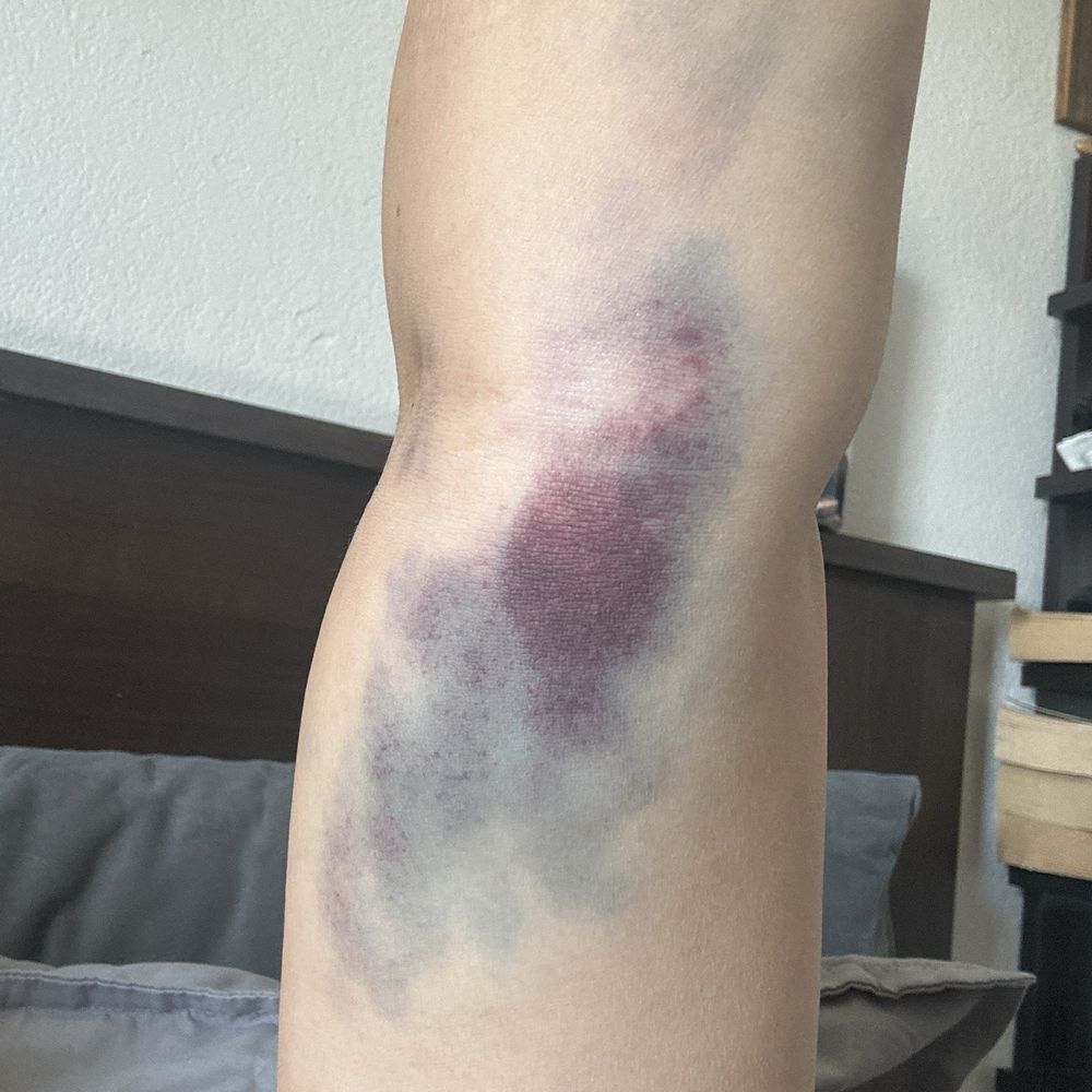 Biolife Plasma Services Tucson, AZ - Last Updated January 2026 - Yelp, image size:1000x1000